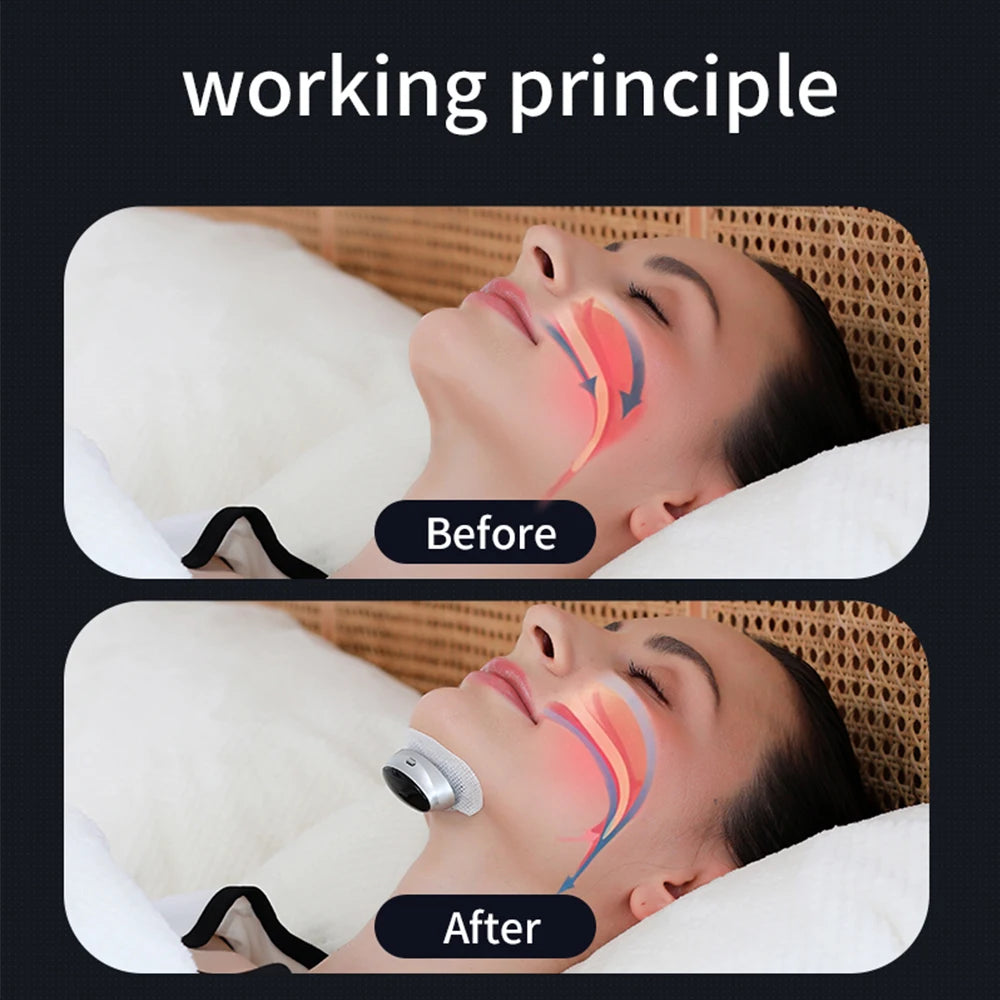 Smart Anti-Snoring Device